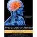 The Cause of Autism - Concepts and Misconceptions