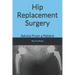 Hip Replacement Surgery: Advice From a Patient