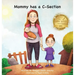 Mommy has a C-Section