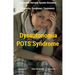 Dysautonomia Pots Syndrome: All You Need To Know About Dysautonomia Or POTS Syndrome, All The Symptoms, How To Diagnose POTS Syndrome And The Best