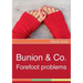 Bunion & Co.: Forefoot problems