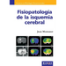 Fisiopatología de la isquemia cerebral