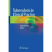 Tuberculosis in Clinical Practice