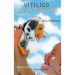 Vitiligo Doesn't Scare Me