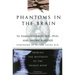 Phantoms in the Brain
