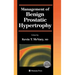 Management of Benign Prostatic Hypertrophy