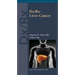 DX/Rx: Liver Cancer: Liver Cancer