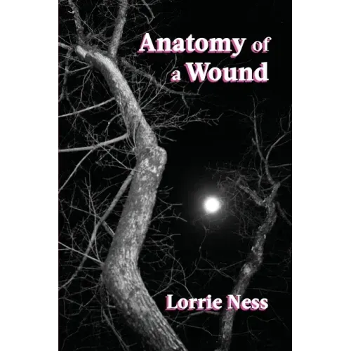 Anatomy of a Wound