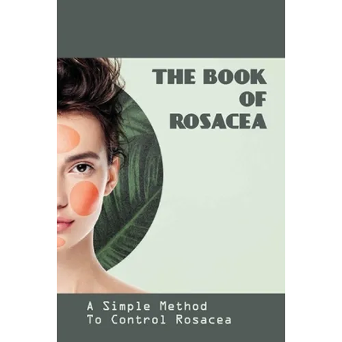 The Book Of Rosacea- A Simple Method To Control Rosacea: Rosacea Treatment For Face