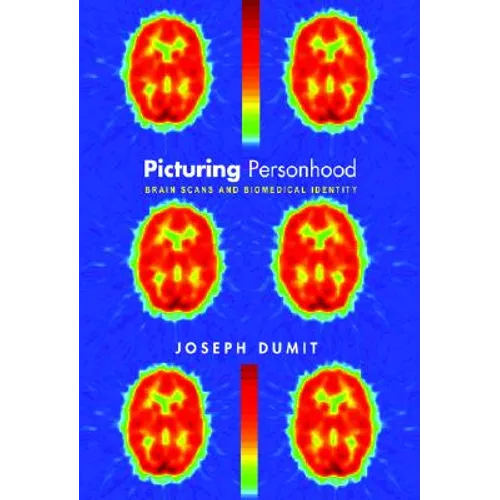 Picturing Personhood: Brain Scans and Biomedical Identity