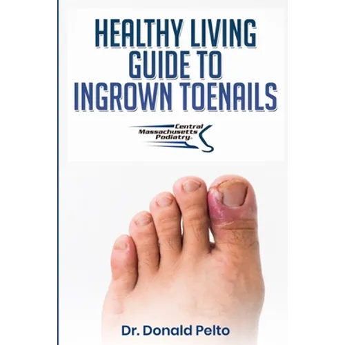 The Healthy Living Guide to Ingrown Toenails