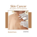 Skin Cancer: Recognition and Management