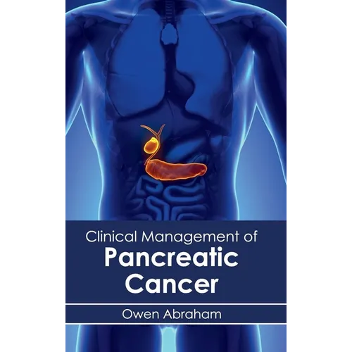 Clinical Management of Pancreatic Cancer