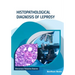 Histopathological Diagnosis Of Leprosy