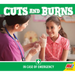 Cuts and Burns