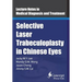 Selective Laser Trabeculoplasty in Chinese Eyes