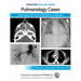 Pediatric Collections: Pulmonology Cases: Case Reports from Pediatrics in Review
