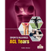 ACL Tears