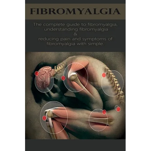 Fibromyalgia: The complete guide to fibromyalgia, understanding fibromyalgia, and reducing pain and symptoms of fibromyalgia with simple treatment met