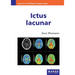 Ictus lacunar