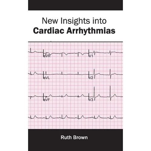 New Insights Into Cardiac Arrhythmias