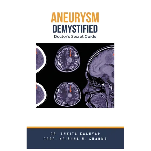 Aneurysm Demystified: Doctor's Secret Guide