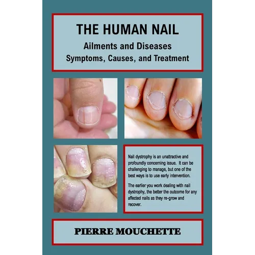 THE HUMAN NAIL - Ailments and Diseases: Symptoms, Causes, and Treatment