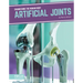 Artificial Joints