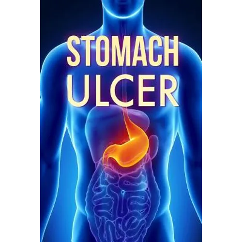 Stomach Ulcer: Treatment in 60 days!: Stomach Ulcer treatment