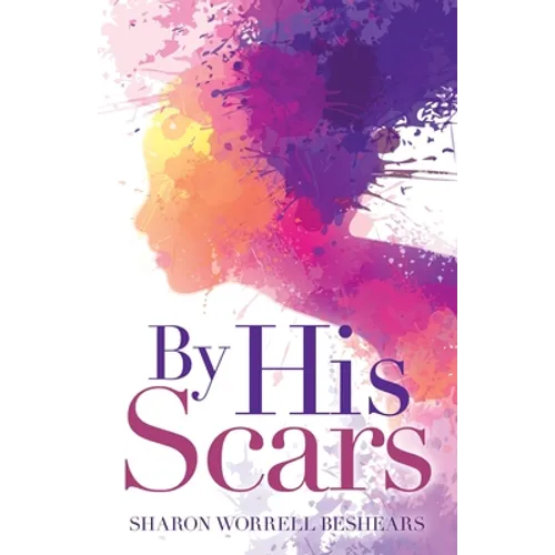 By His Scars