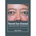 Thyroid Eye Disease: Understanding Graves' Ophthalmopathy