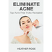 Eliminate Acne: Top Acne Free Tricks Revealed!