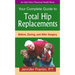 Your Comp GT Total Hip Replace: Before, During, and After Surgery