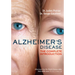 Alzheimer's Disease: The Complete Introduction