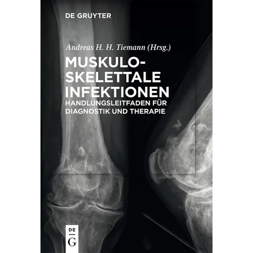 Muskuloskelettale Infektionen