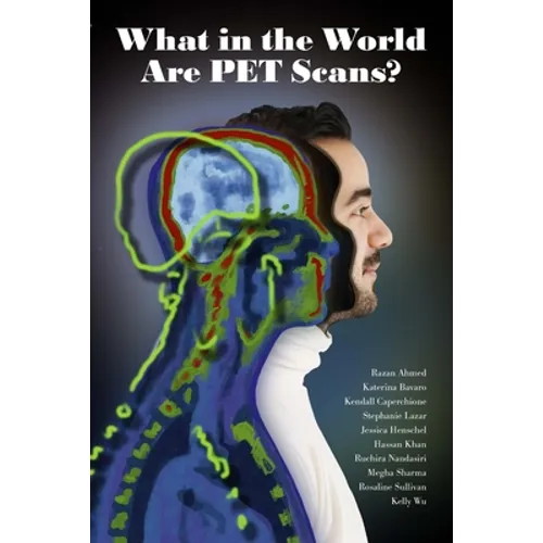 What in the World are PET Scans?