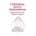 Cerebral Sinus Thrombosis: Experimental and Clinical Aspects