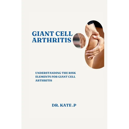 Giant Cell Arthritis: Understanding the Risk Elements for Giant Cell Arthritis
