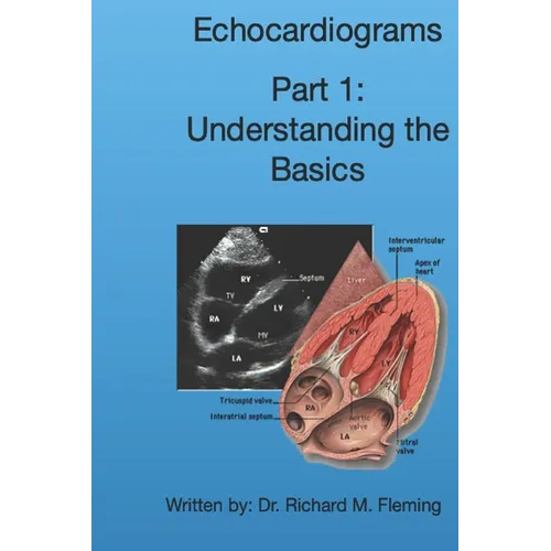 Echocardiograms - Part 1: Understanding the Basics.