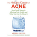 The Hidden Cause of Acne: How Toxic Water Is Affecting Your Health and What You Can Do about It