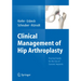 Clinical Management of Hip Arthroplasty: Practical Guide for the Use of Ceramic Implants