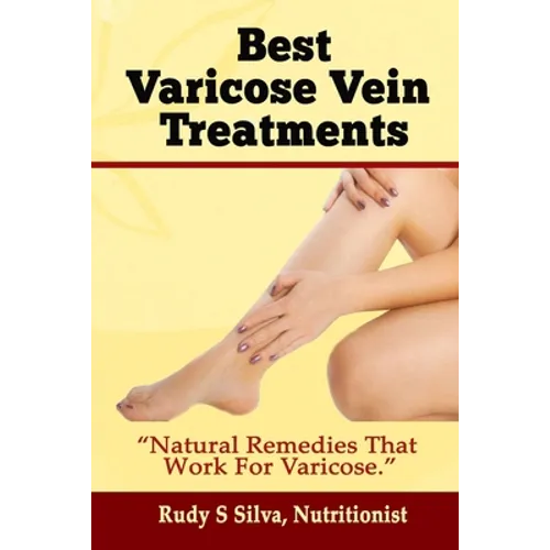 Best Varicose Vein Treatments: Natural Remedies That Work for Varicose