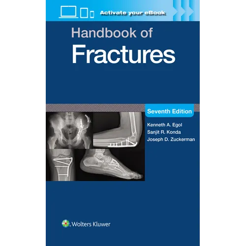 Handbook of Fractures: Print + eBook with Multimedia