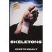Skeletons: Extended Edition