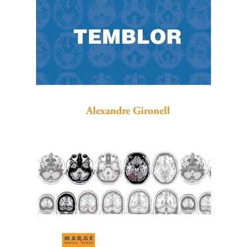 Temblor