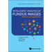 Intelligent Analysis of Fundus Images: Methods and Applications