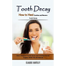 Tooth Decay: How to Heal Cavities and Reverse Tooth Decay (How I Stopped Tooth Decay and Avoided Dental Surgery With This All Natural)