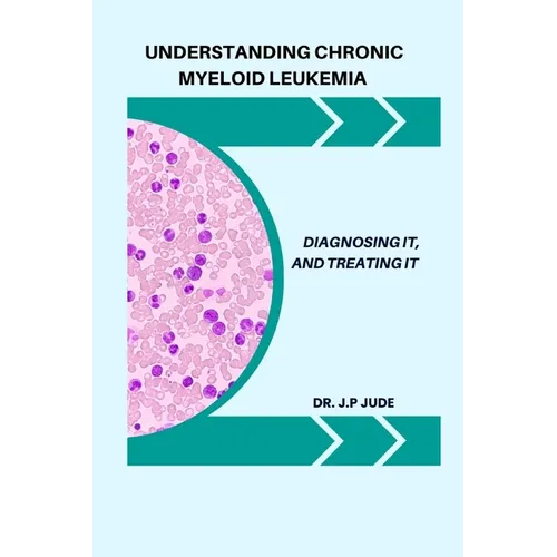 Understanding Chronic Myeloid Leukemia: Diagnosing It, and Treating It