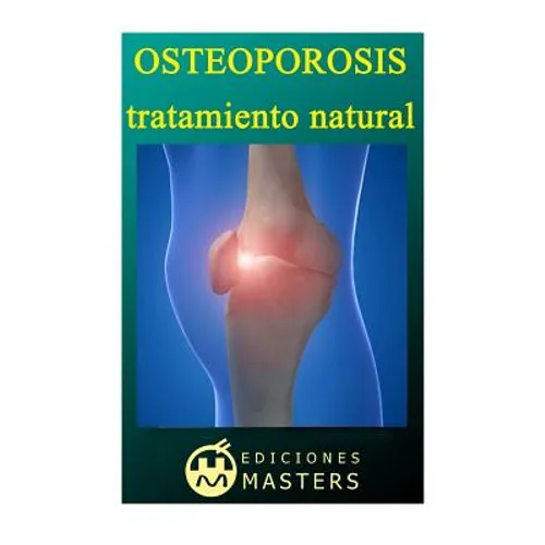 Osteoporosis: Tratamiento natural