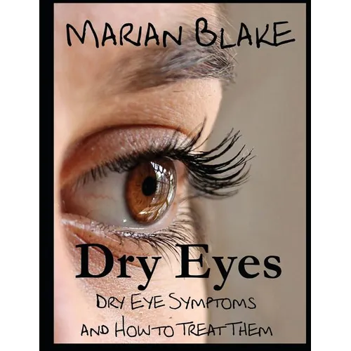 Dry Eyes (Large Print): Dry Eye Symptoms and how to treat them